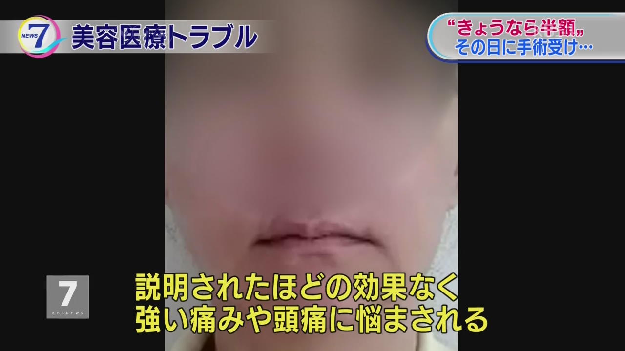 日, 의료사고 잇따르자 성형 전후 사진 금지