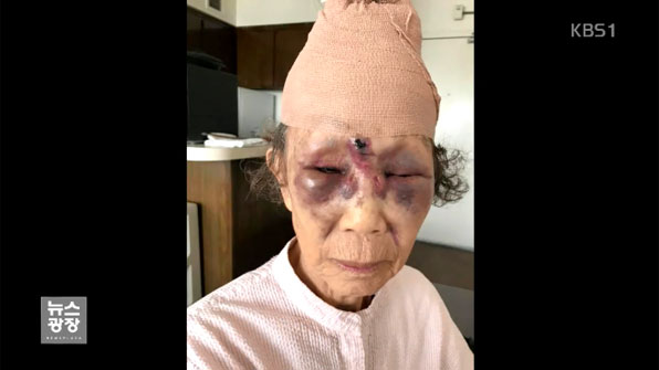 LA서 80대 한인 여성 ‘묻지마 폭행’…손녀가 SNS에 글올려