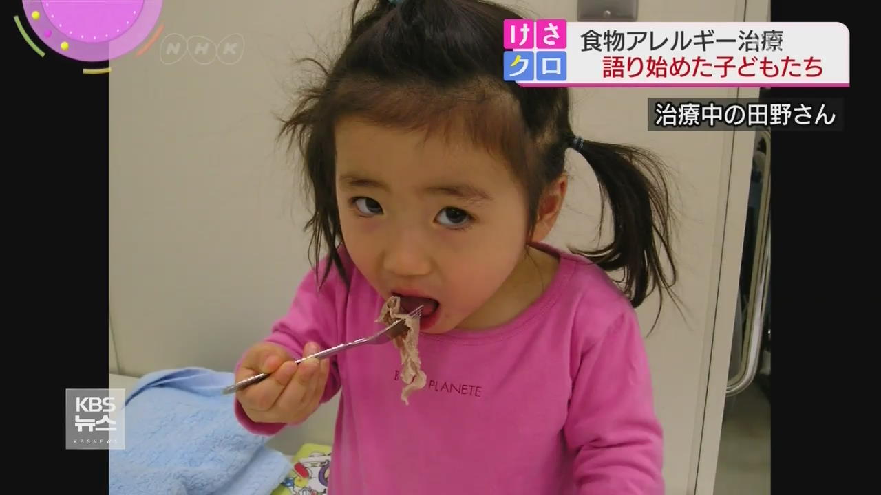 日 “음식 알레르기 이렇게 극복했다”
