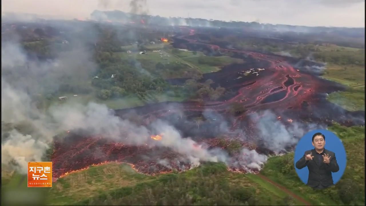 하와이 화산 분출 계속…첫 중상자 발생