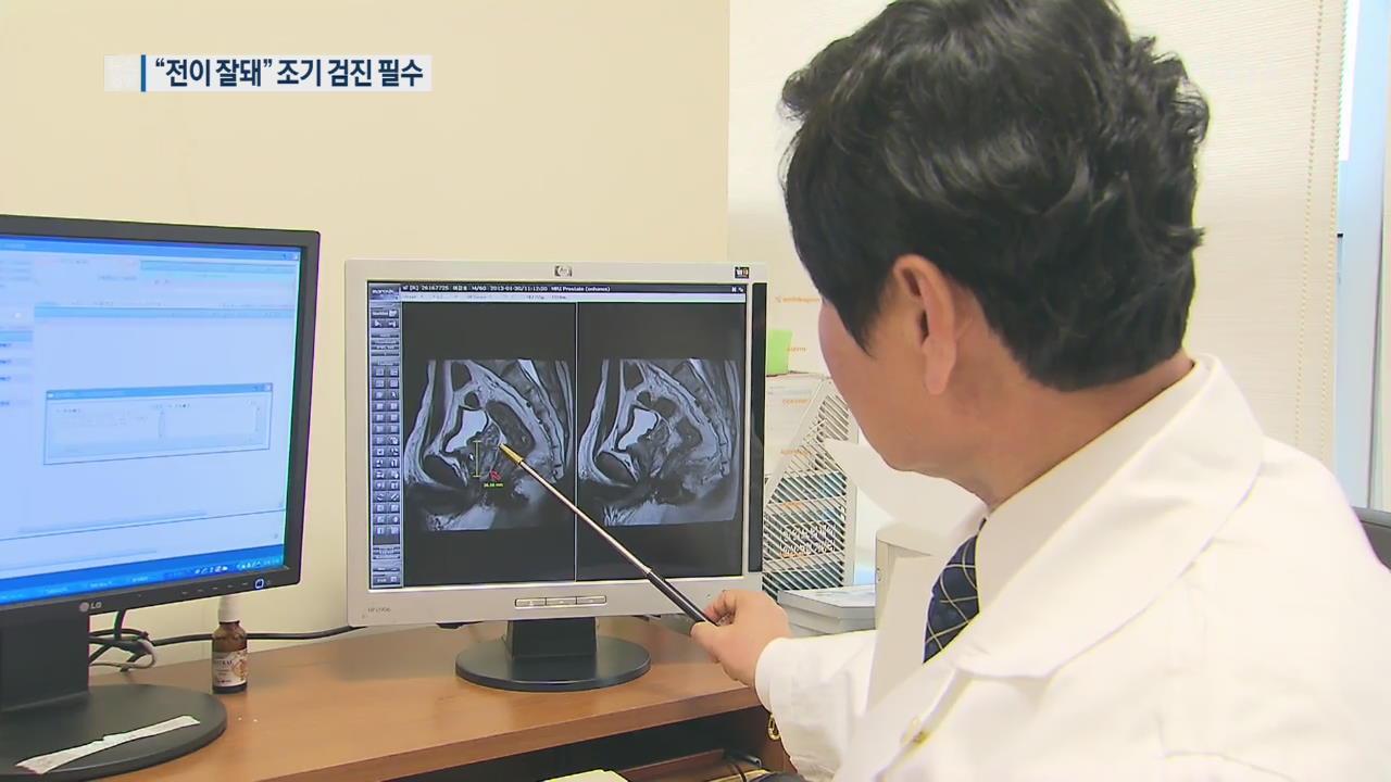 한국인 전립선암 공격적…조기 검진 필요