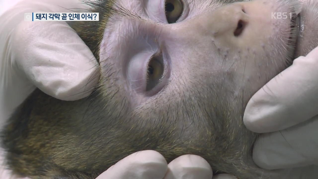돼지 각막 이식 원숭이 1년 생존…임상 시험 기대