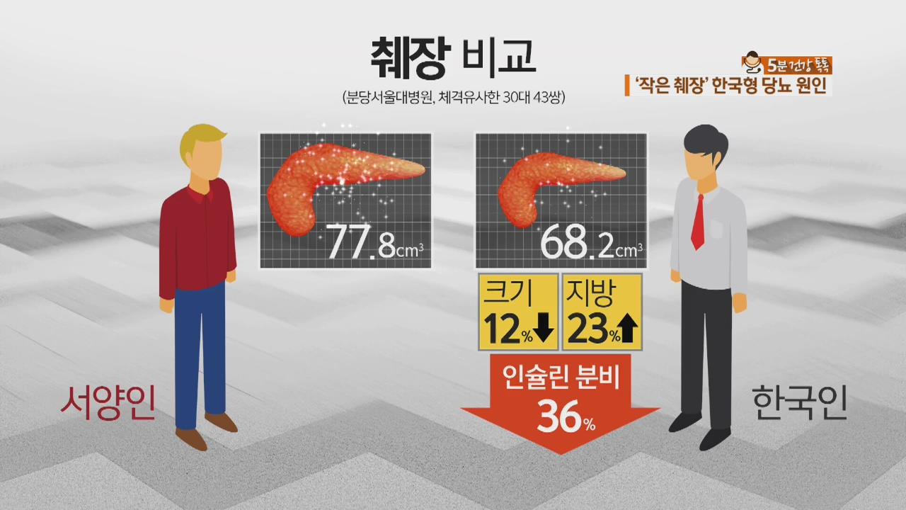 [5분 건강 톡톡] 췌장 작은 한국인…당뇨병 위험 증가