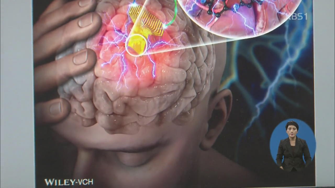 “전자피부로 ‘뇌 질환 치료’ 새 길 열다!”…의학계 주목