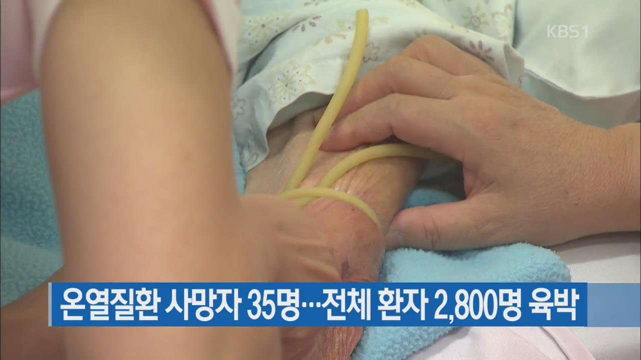 온열 질환 사망자 35명…전체 환자 2,800명 육박