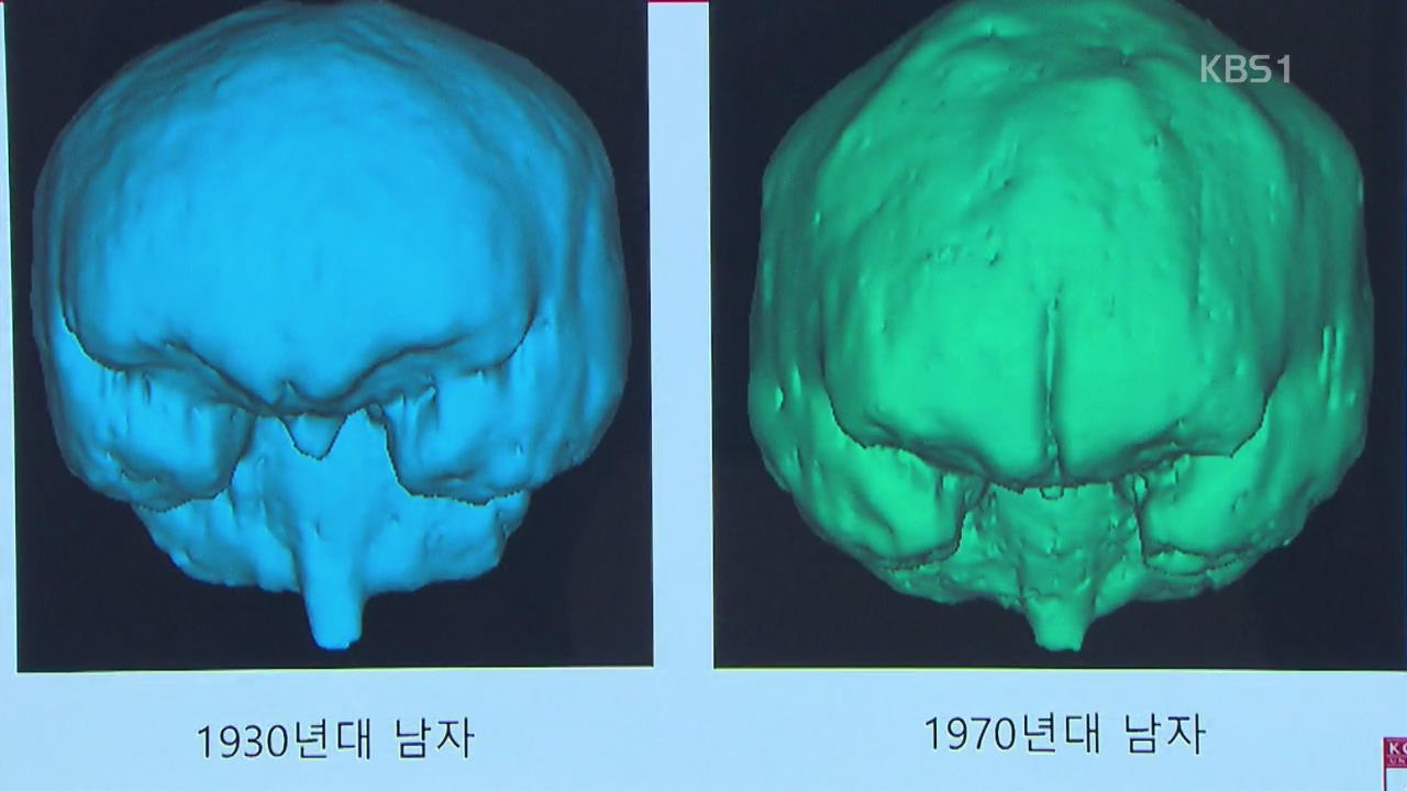 한국인 머리 크기 광복 이후 커졌다