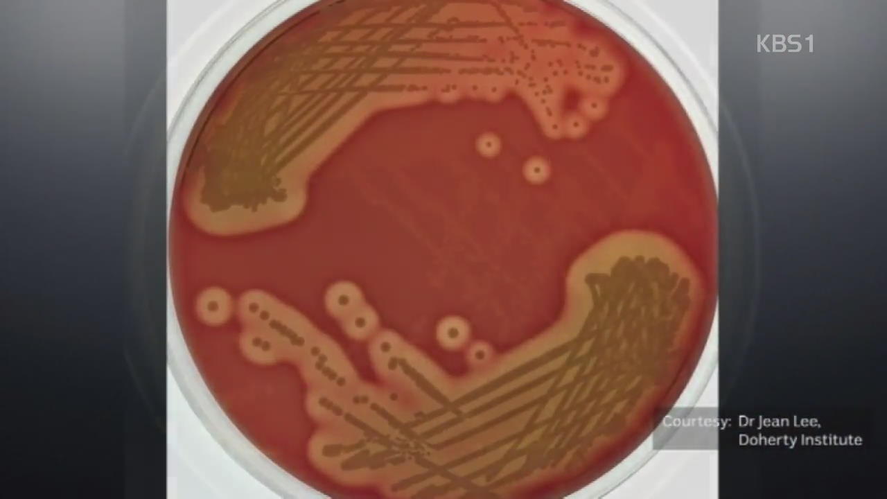 호주, ‘모든 항생제에 내성’ 새 슈퍼박테리아 발견