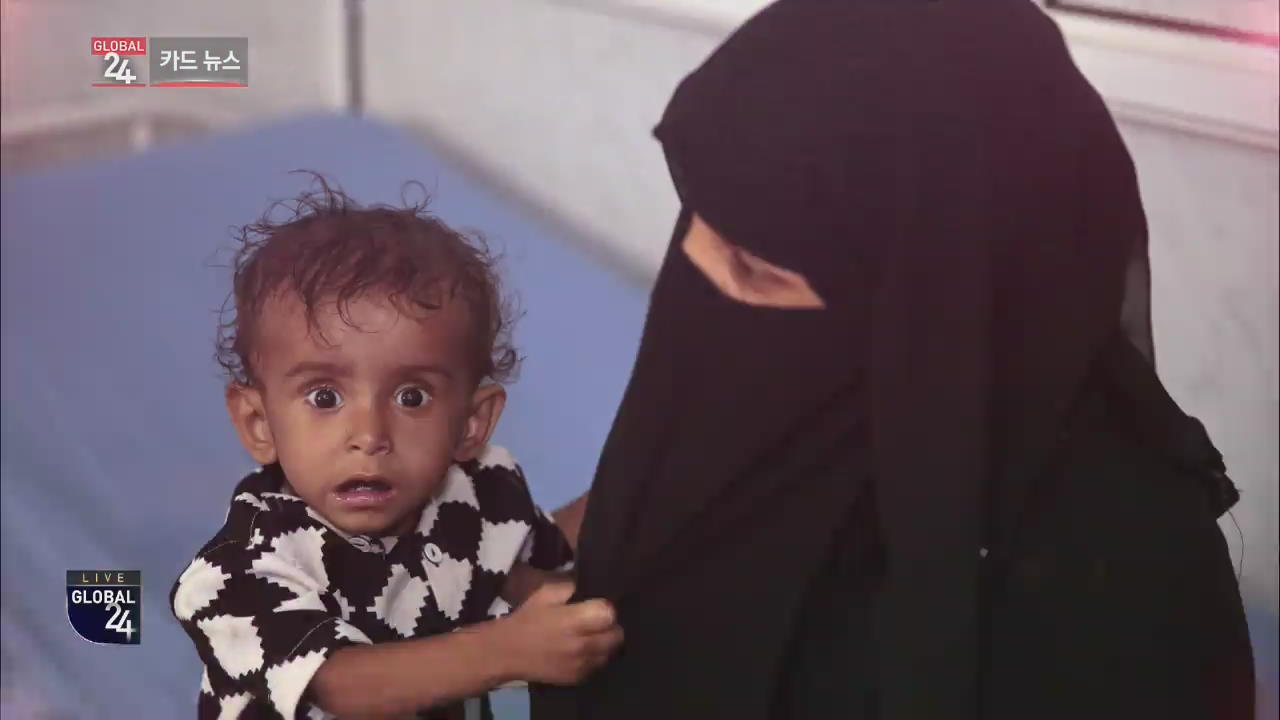 [글로벌24 카드뉴스] 예멘 어린이의 현실 담은 전시회
