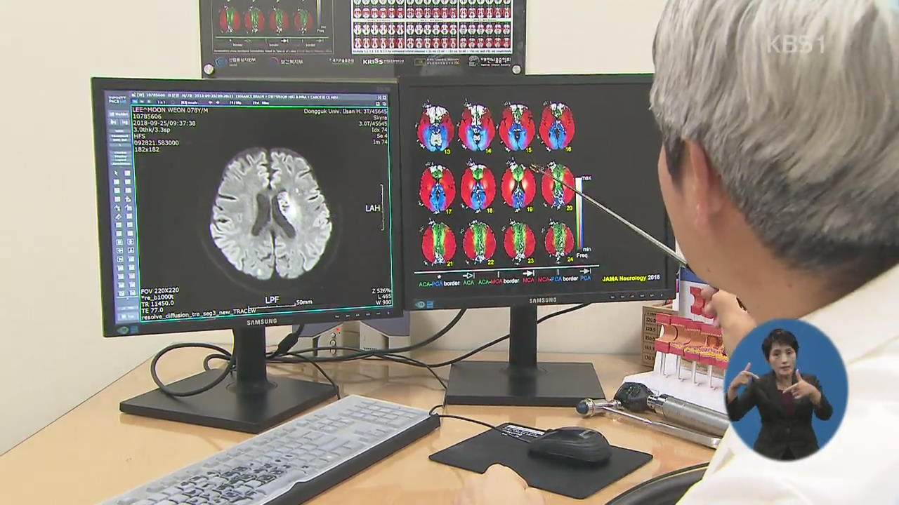 ‘고해상도 뇌혈류 지도’ 최초 완성…뇌경색 진단 정확도 높인다
