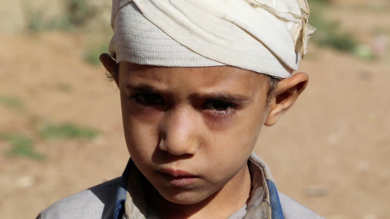 [지구촌 포토] 4년째 울리는 총성…예멘 아이들의 눈물