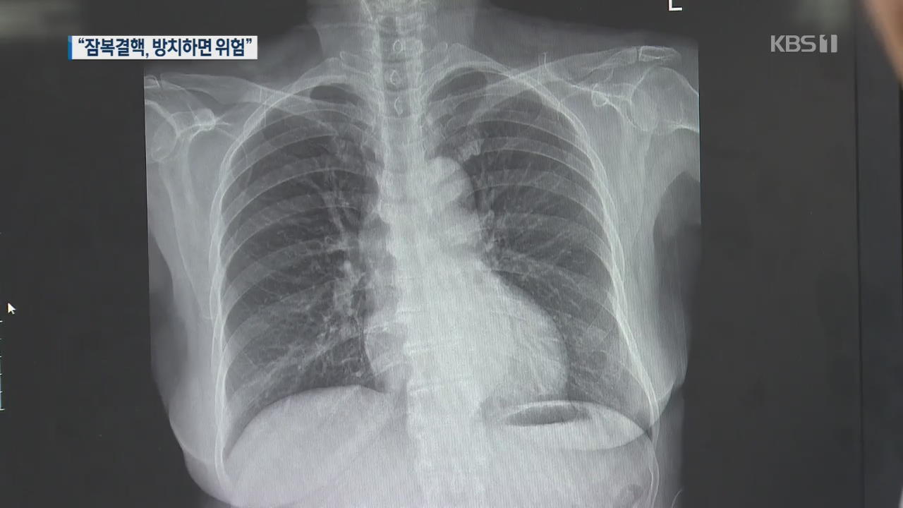 국민 15%, 잠복결핵…“방치하면 결핵 발병 확률 7배”