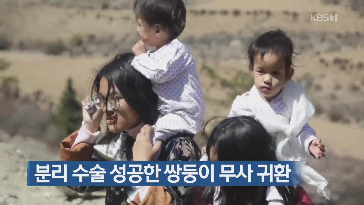 [지금 세계는] 분리 수술 성공한 쌍둥이 무사 귀환