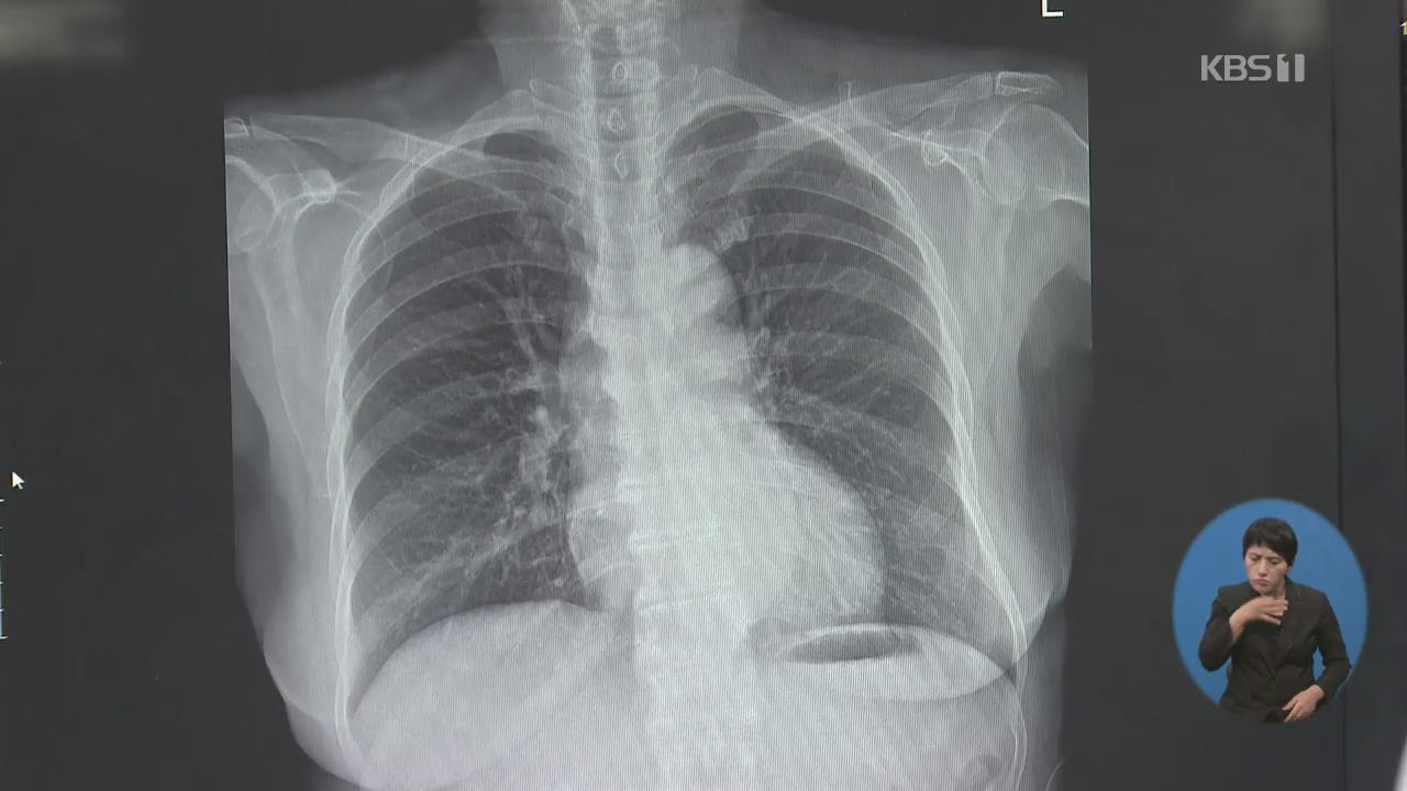 국민 15%, 잠복결핵…“방치하면 결핵 발병 확률 7배”