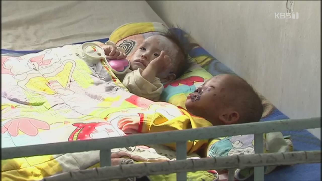 북한, ‘식수 오염’ 심각…아동 10% 설사병 고통