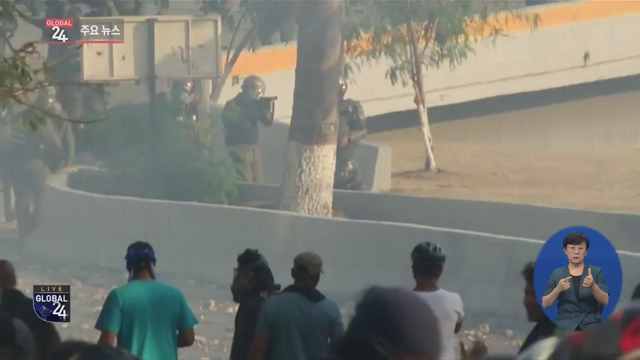 [글로벌24 주요뉴스] 베네수엘라서 시위 참여한 16세 고무탄 50발 맞고 실명