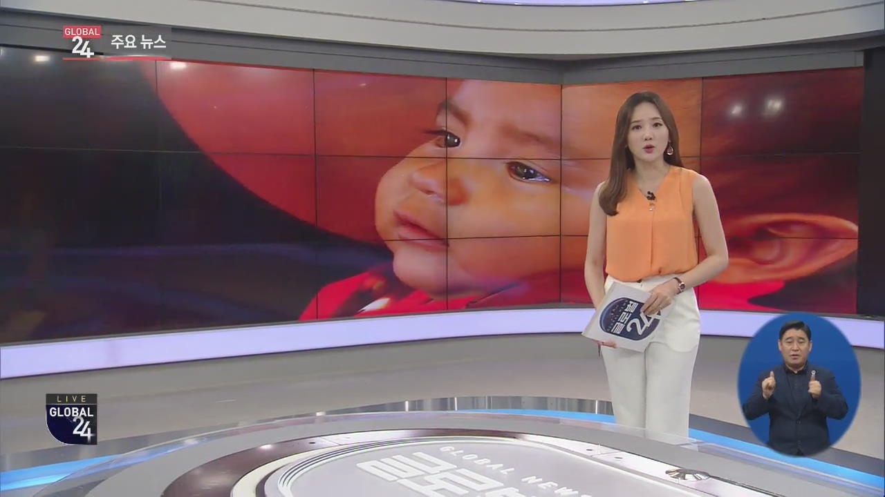 [글로벌24 주요뉴스] 콜롬비아, ‘무국적’ 베네수엘라 아기에 시민권 부여