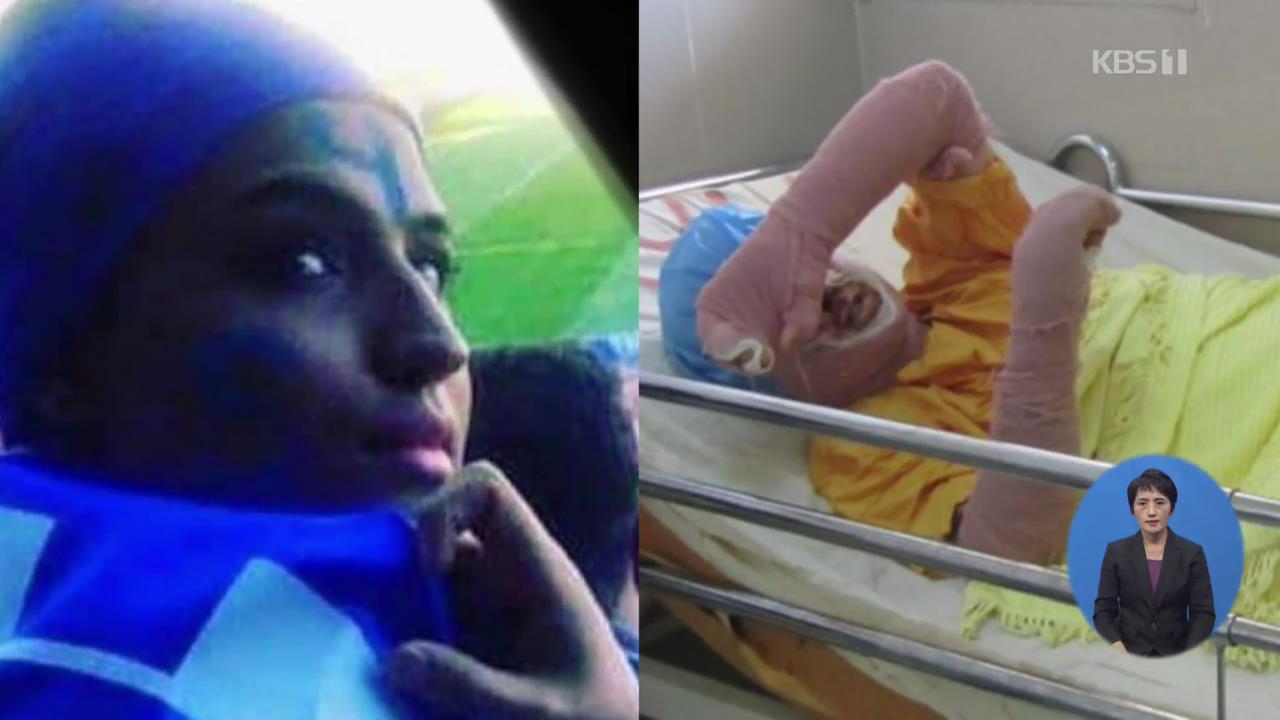 ‘축구장 가려다 징역 위기’…이란 여성 분신 사망