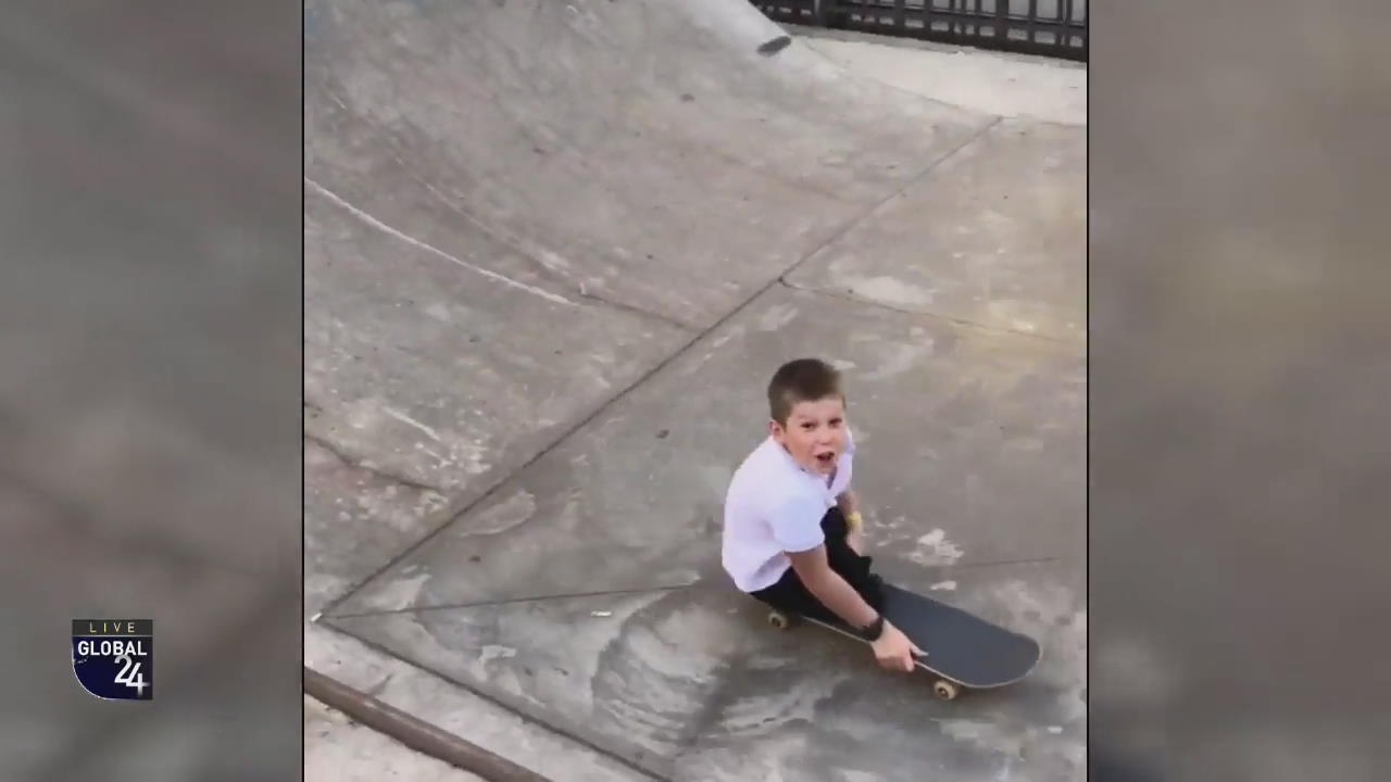 [글로벌24 스토리] ‘다리 대신 팔로…’ 10살 스케이트보더