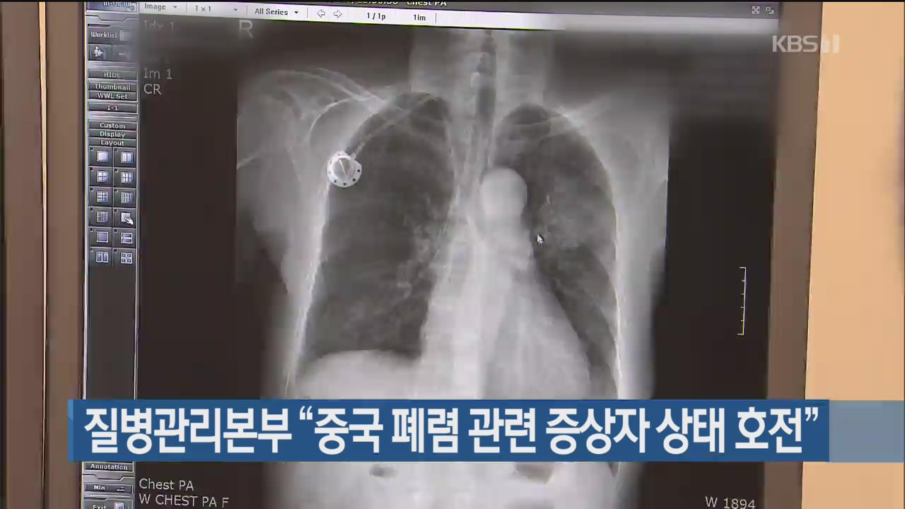 질병관리본부 “중국 폐렴 관련 증상자 상태 호전”