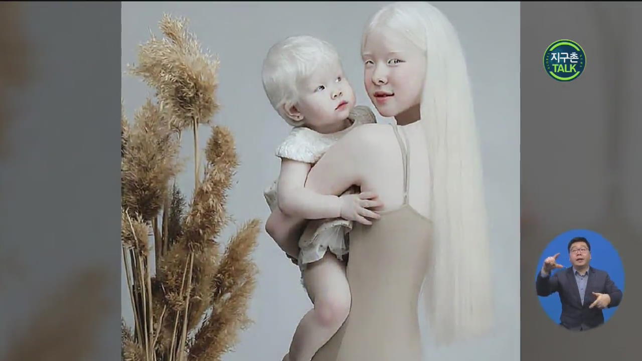 [지구촌 Talk] 주목받은 하얀 외모…카자흐 ‘알비노’ 자매 모델