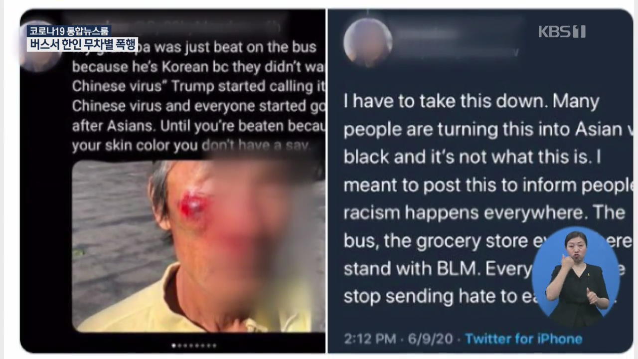 미국서 60대 한국인 ‘중국 바이러스’라며 무차별 구타