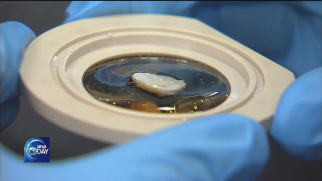 SCIENTIFIC PROOF OF SOFT DRINKS HARMING TEETH