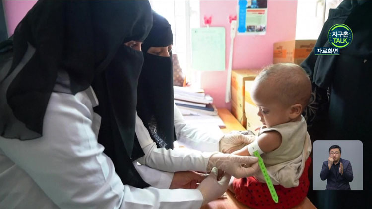 [지구촌 Talk] 예멘 남부, 올 들어 어린이 영양실조 심화