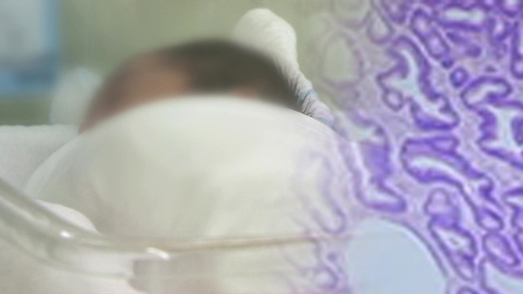 송파 산후조리원 신생아 18명 로타바이러스 감염