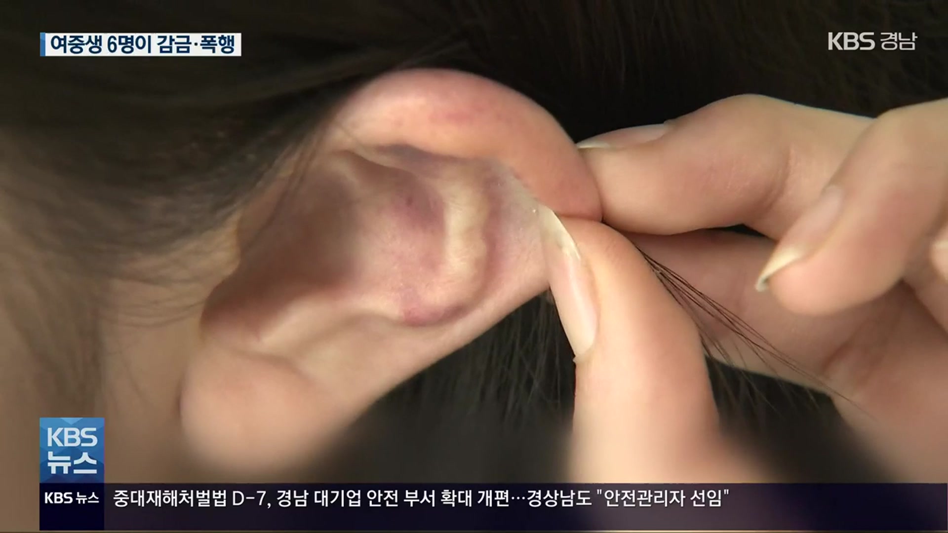 10대 여학생 6명이 친구 감금·폭행…동영상 촬영까지