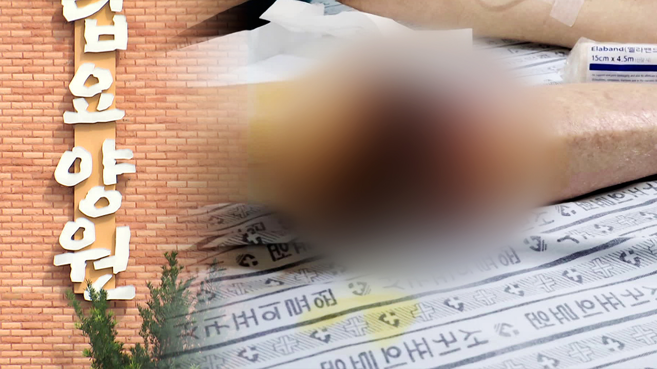 “아버지 무릎 썩는데 공립 요양원서 방치”…경찰 수사