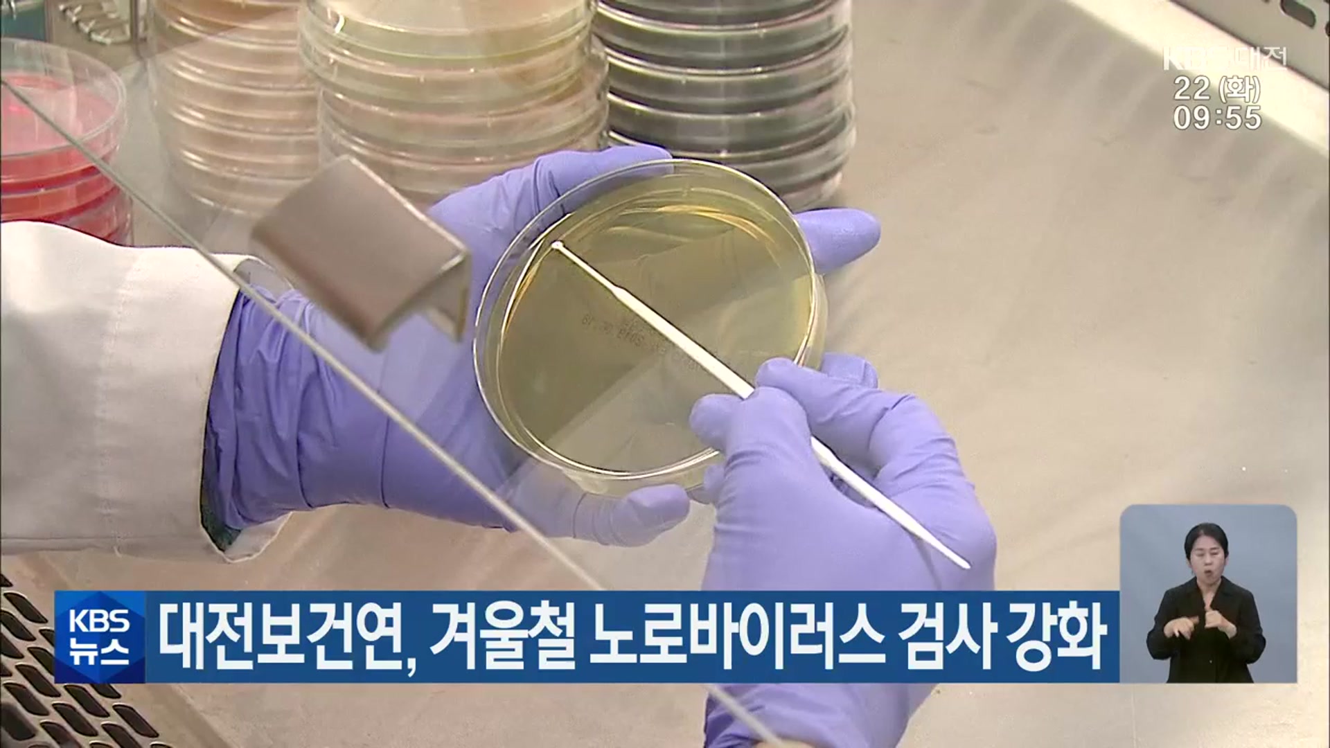 대전보건연, 겨울철 노로바이러스 검사 강화