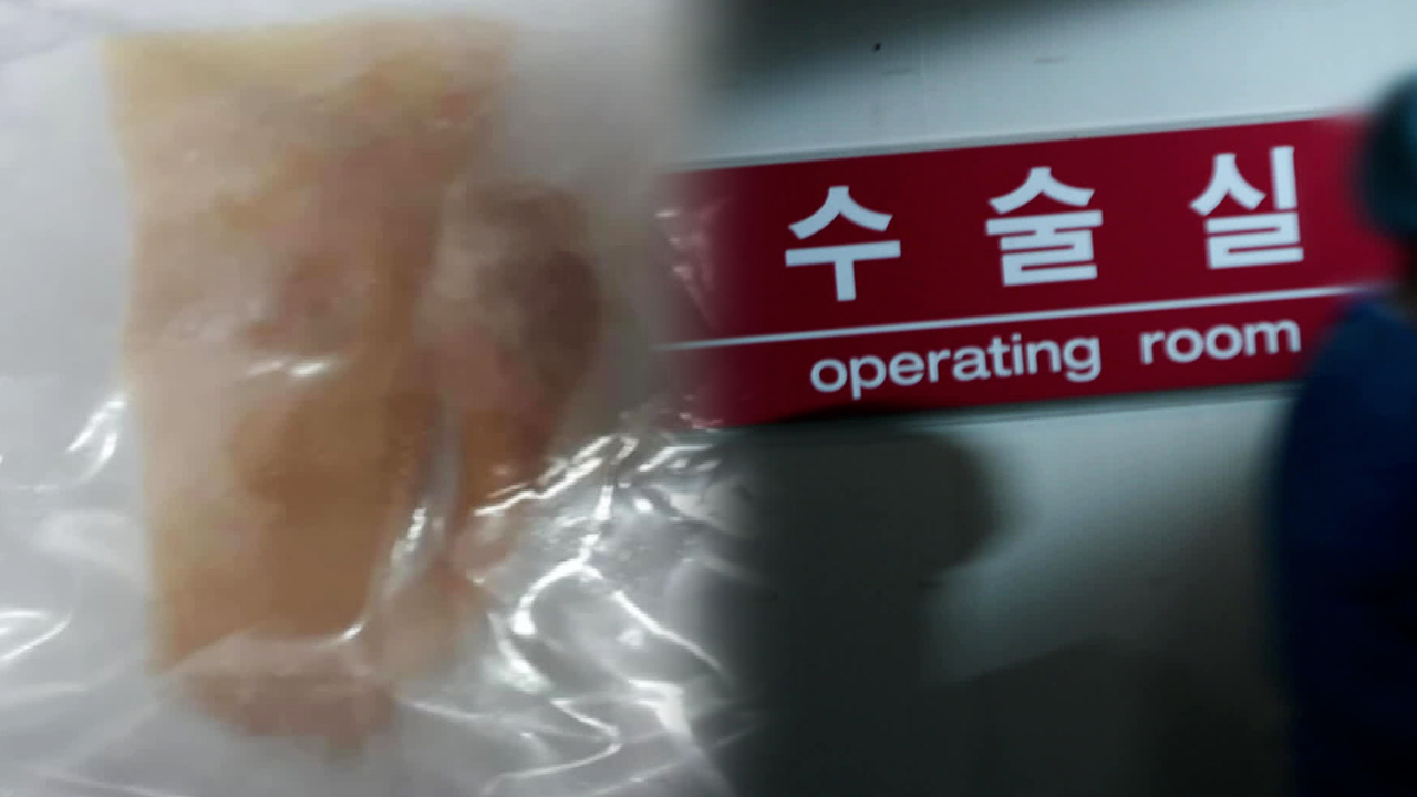 “내 다리에 반쪽짜리 아킬레스건이?”…영업사원 대리수술까지
