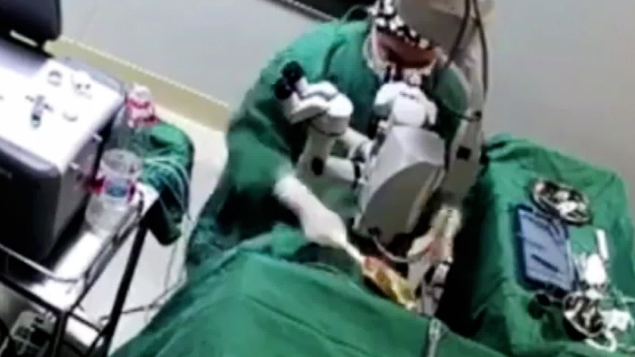 수술 중 환자 머리 때린 중국의사…영상 확산에 뒤늦게 제재