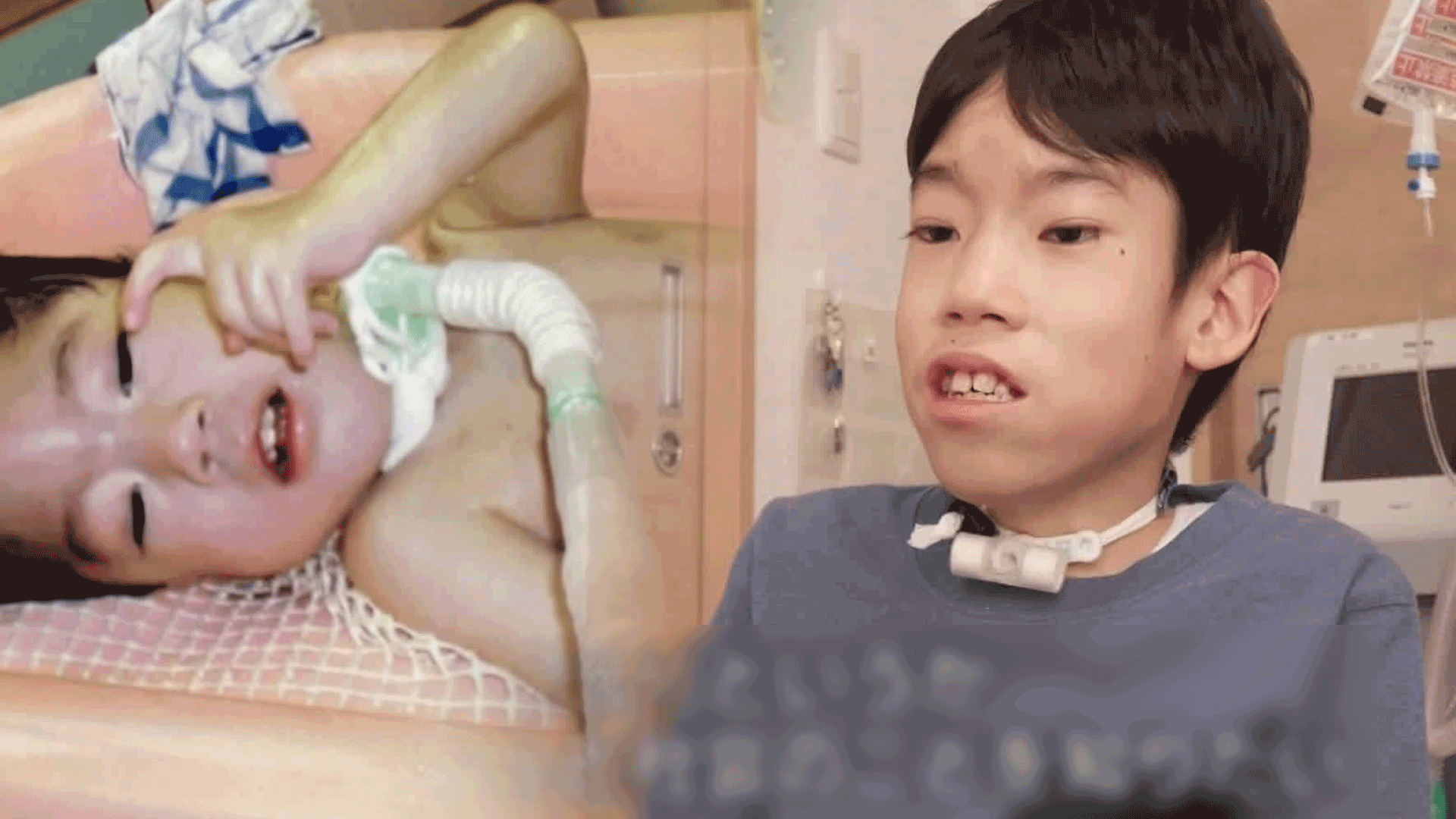 일본, 인공호흡기 단 18살…홀로서기에 도전