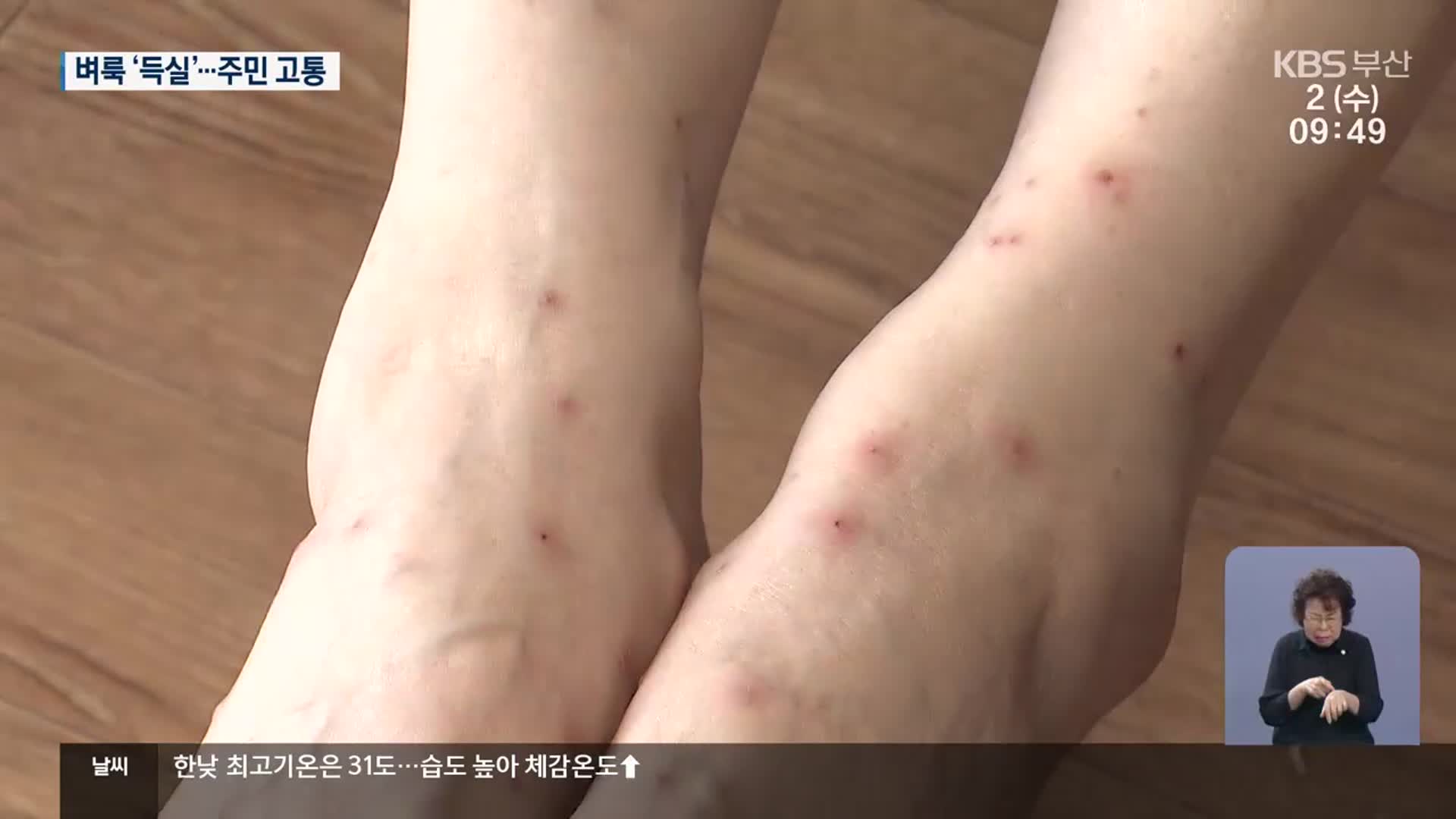 아파트에 번지는 ‘벼룩’…손 놓은 대책