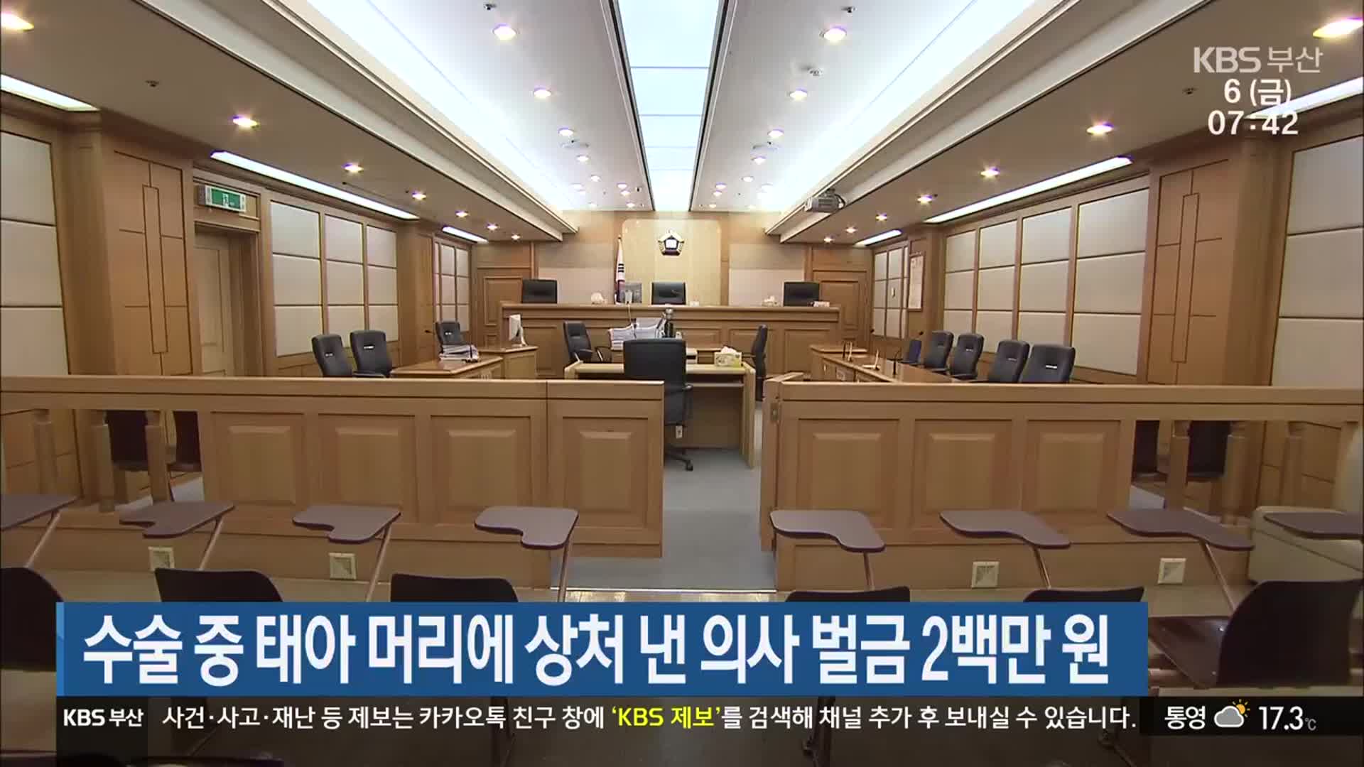 수술 중 태아 머리에 상처 낸 의사 벌금 2백만 원