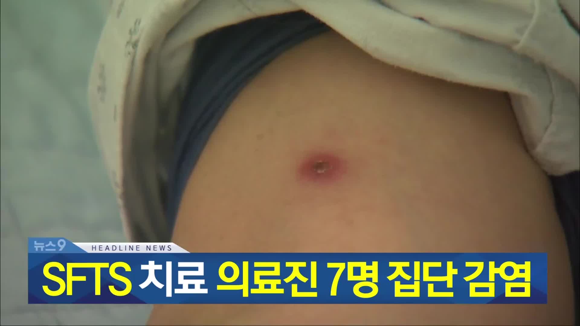 [뉴스9 충북 헤드라인]