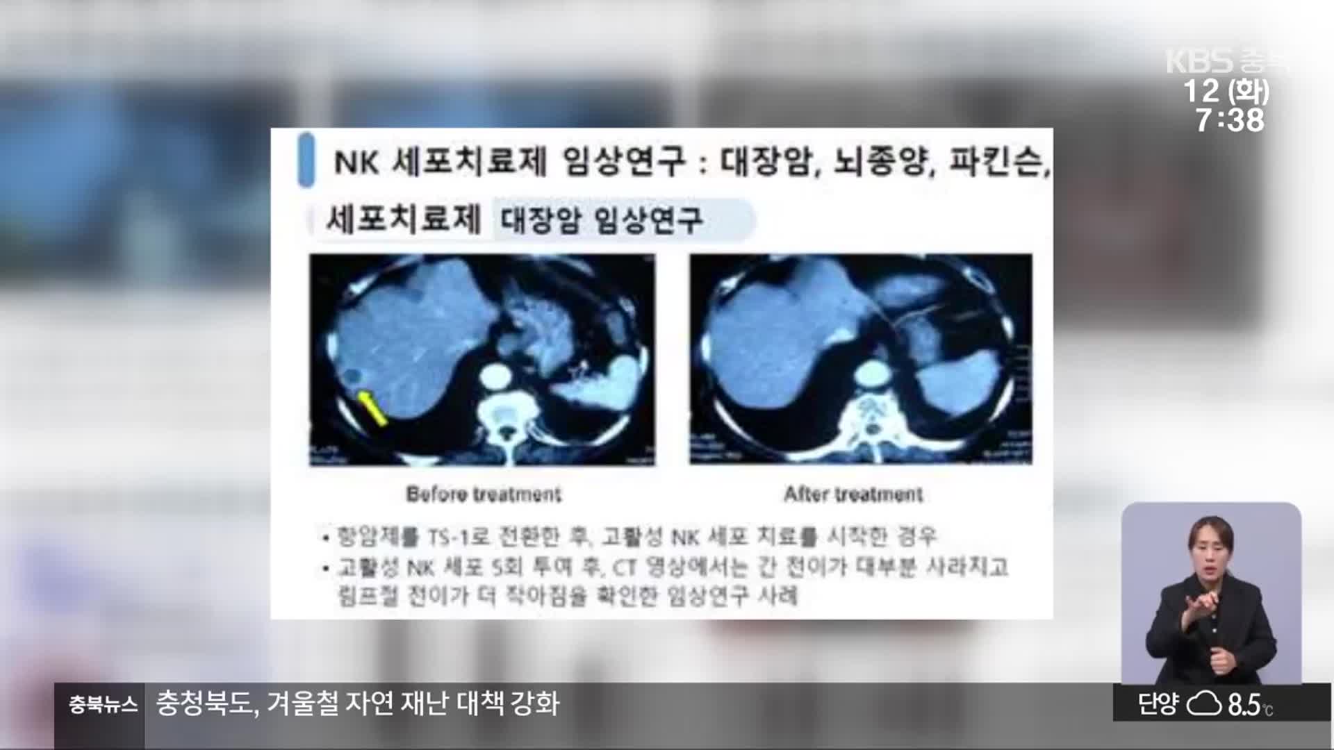 무허가 세포치료제에 속은 충청북도…글로벌 특구 ‘빨간불’