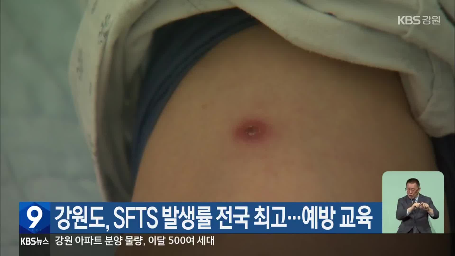 강원도, SFTS 발생률 전국 최고…예방 교육