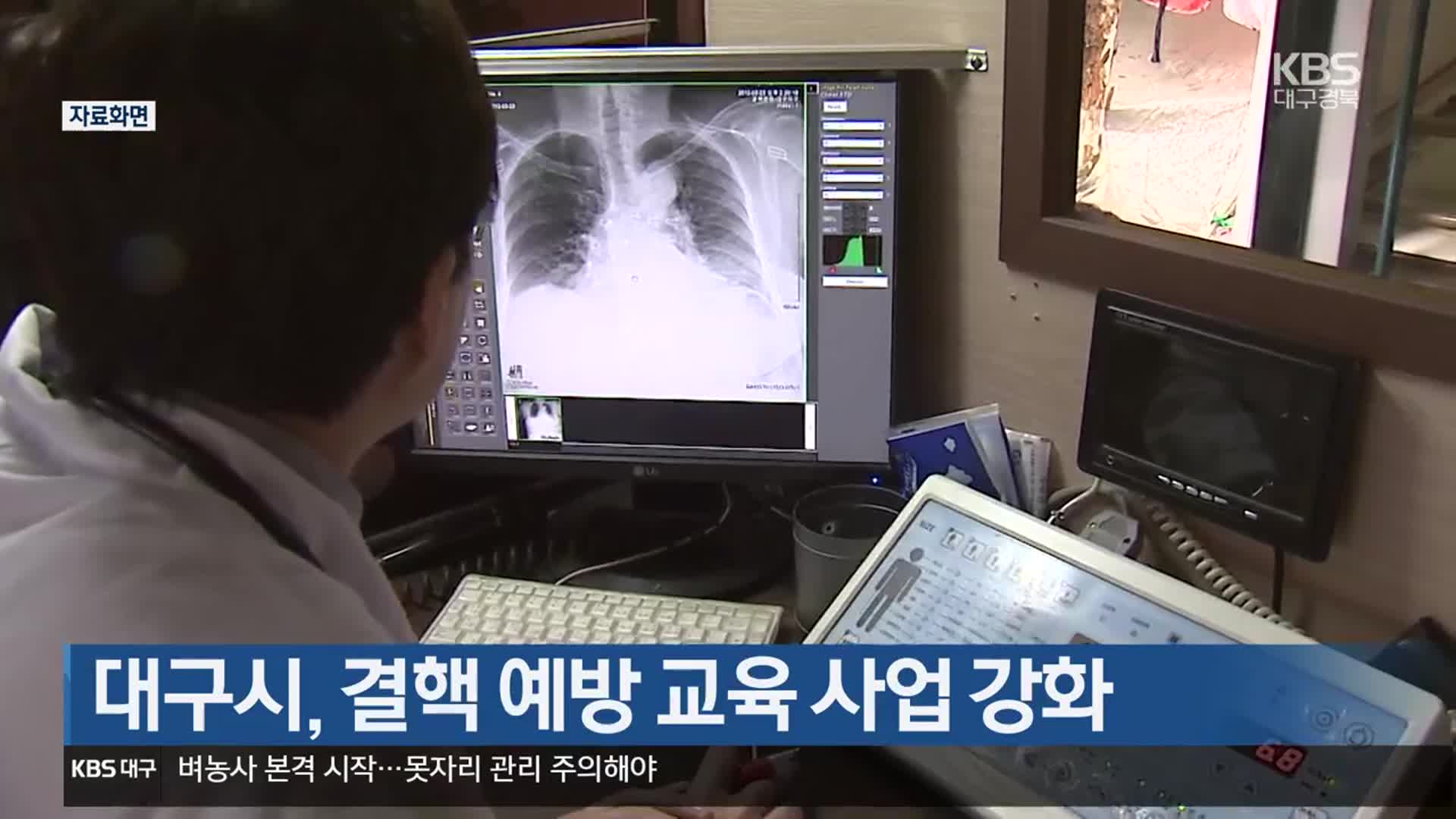 대구시, 결핵 예방 교육 사업 강화