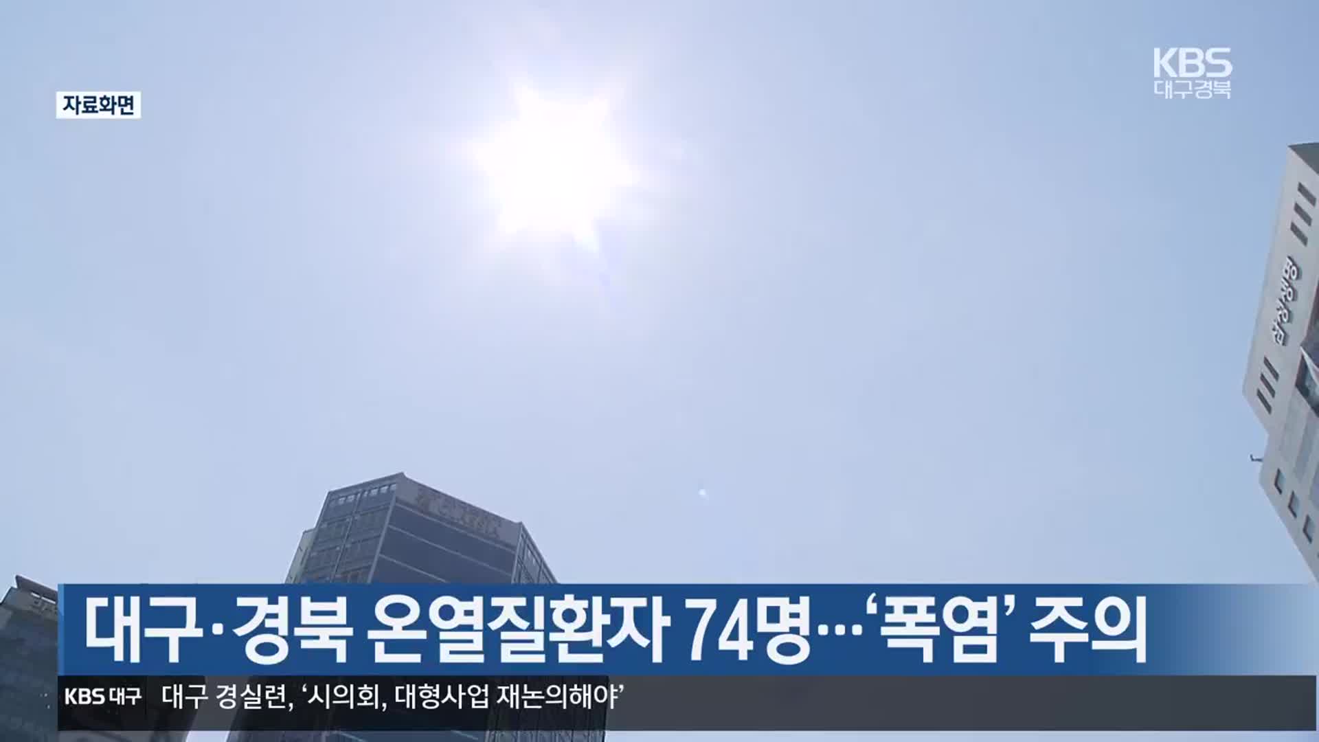 대구·경북 온열질환자 74명…‘폭염’ 주의