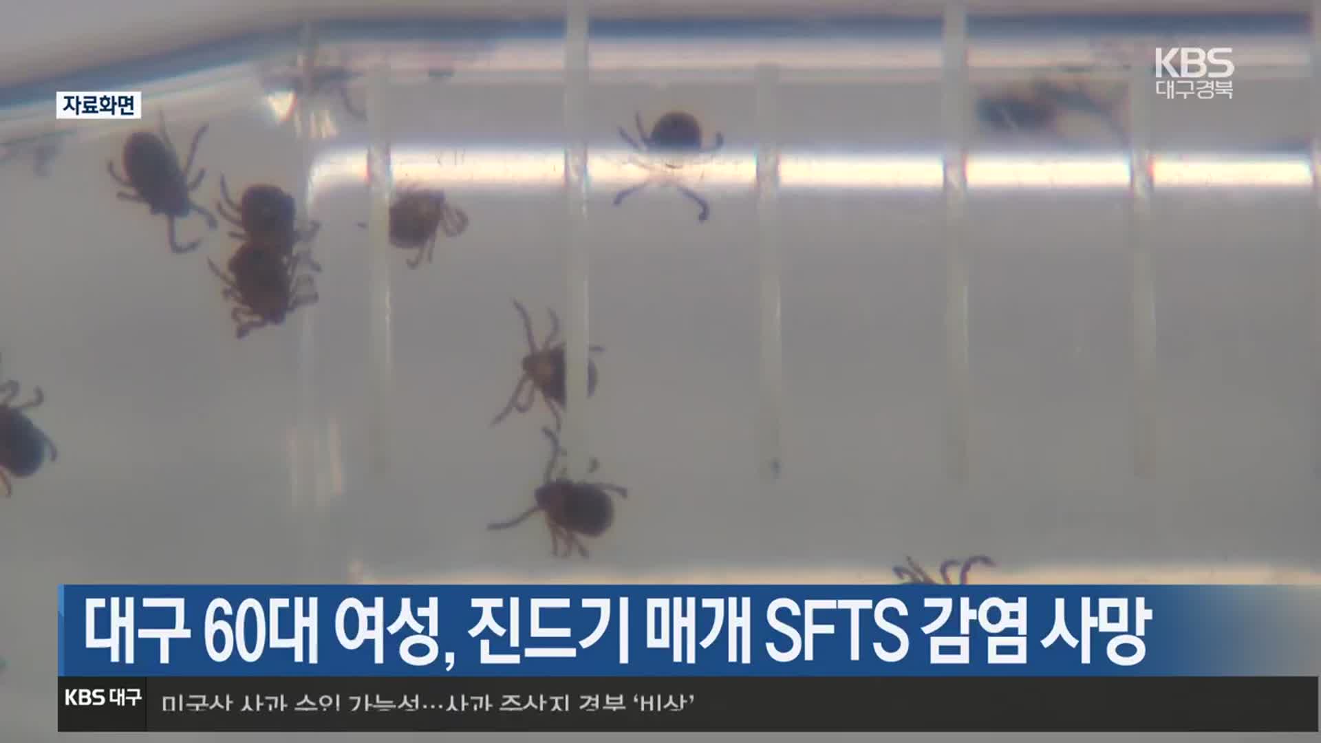 대구 60대 여성, 진드기 매개 SFTS 감염 사망