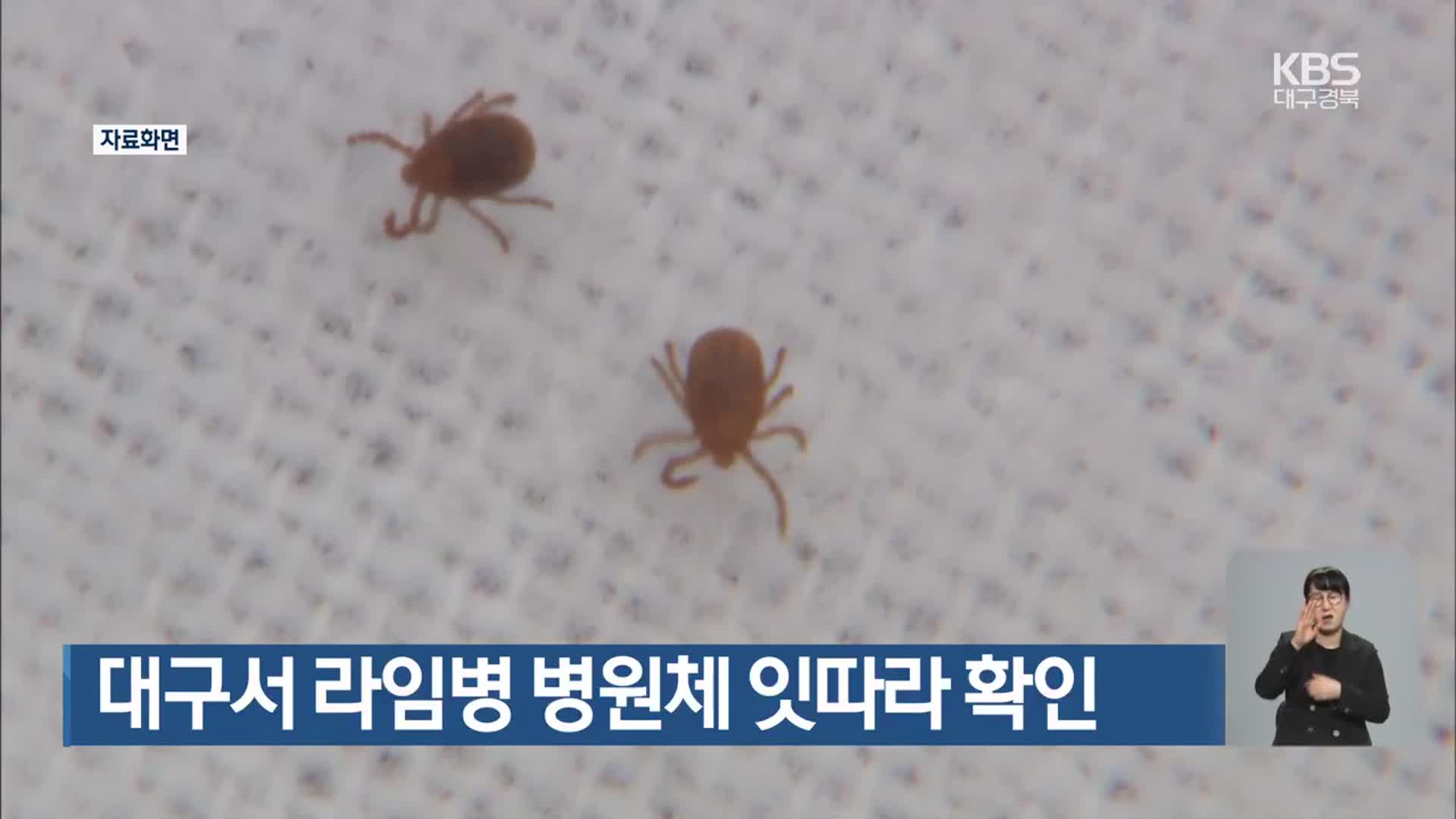 대구서 라임병 병원체 잇따라 확인