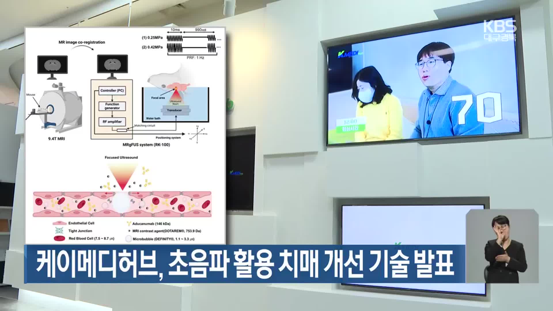 케이메디허브, 초음파 활용 치매 개선 기술 발표
