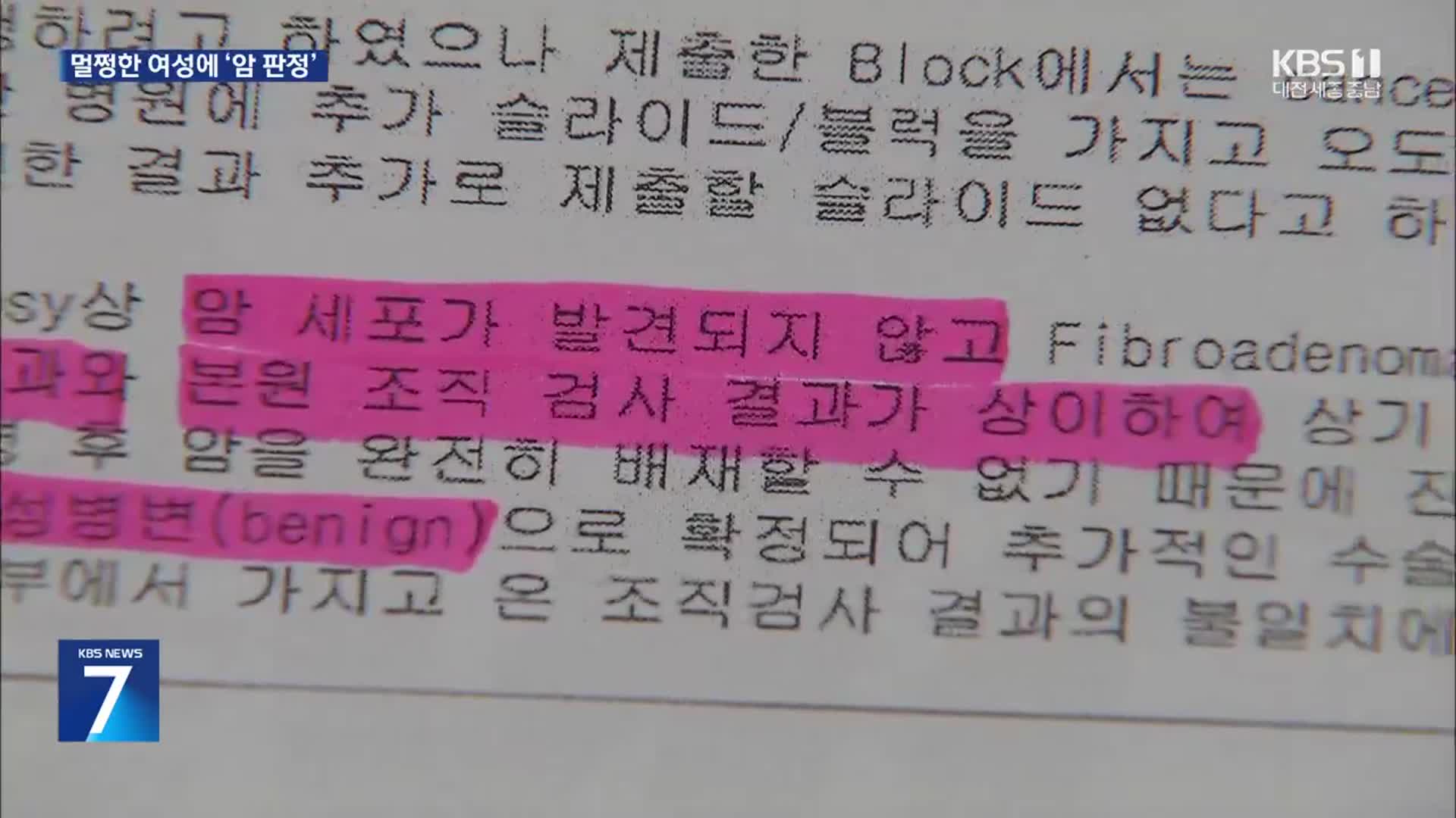 멀쩡한 여성 ‘유방암 확진’…뒤바뀐 검체로 오진