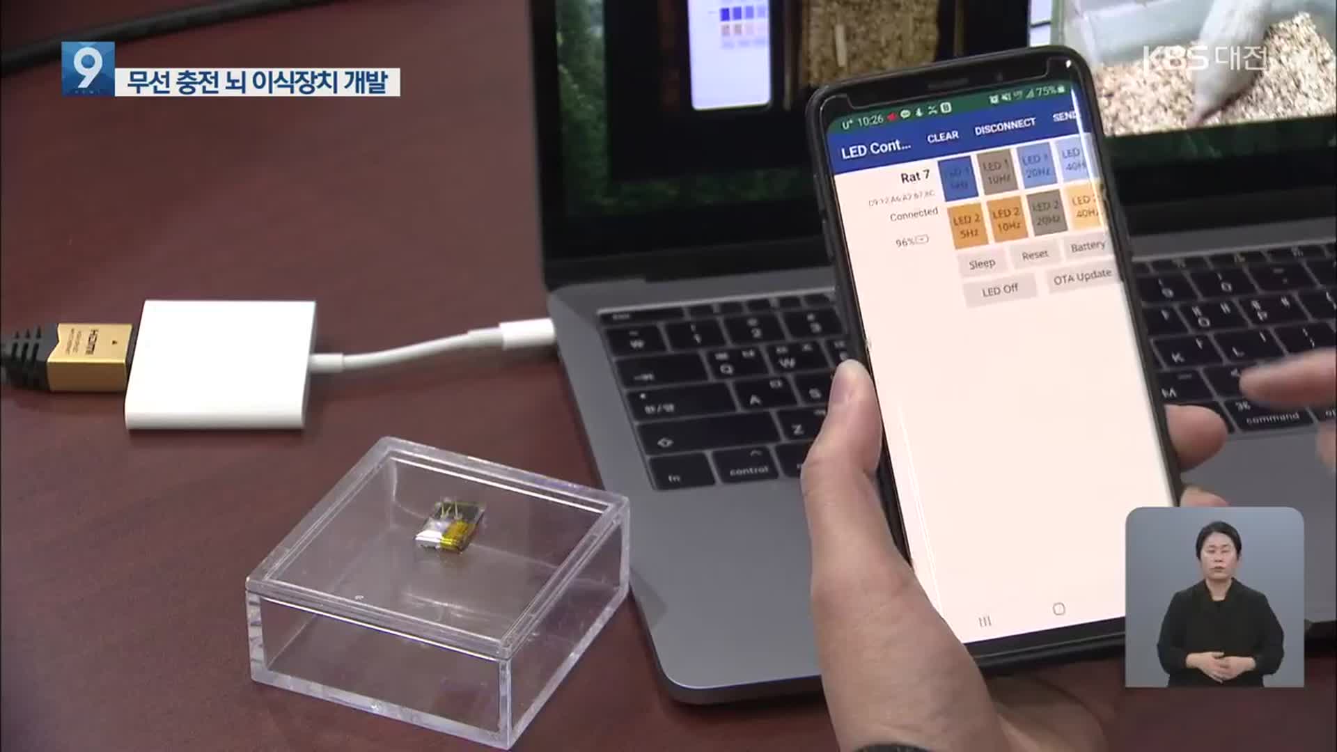 뇌에 이식, 무선 충전·제어 가능…파킨슨 등 치료 적용 주목