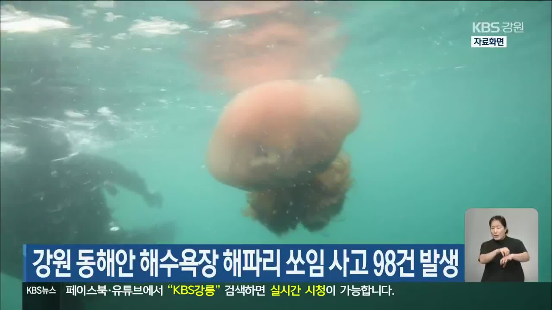 강원 동해안 해수욕장 해파리 쏘임 사고 98건 발생
