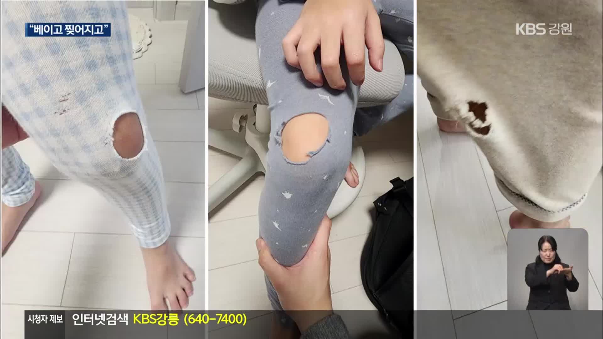 “베이고 찢어지고”…강릉 신축 아파트 하자 논란