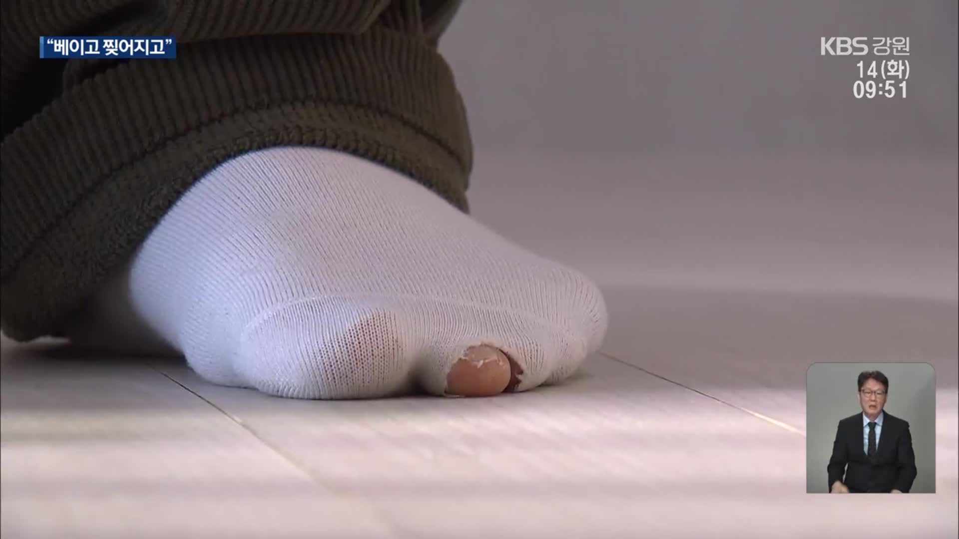 “베이고 찢어지고”…강릉 신축 아파트 하자 논란
