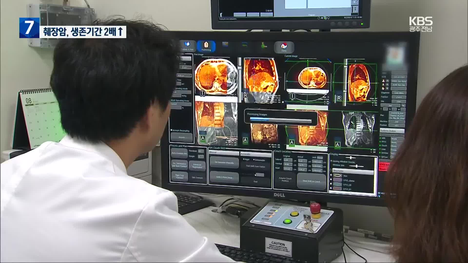 “췌장암, 포기하지 마세요”…생존기간 10년 새 2배↑